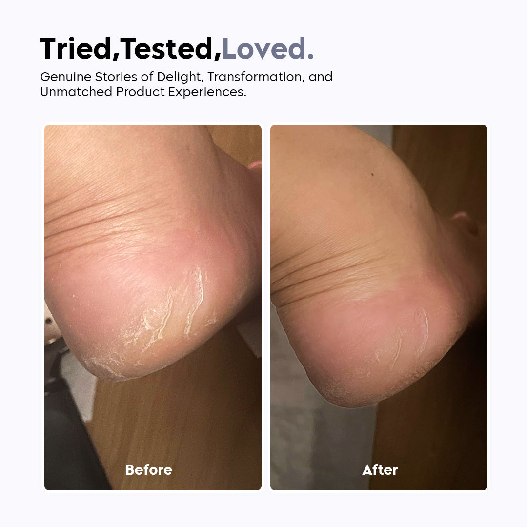 Foot Filer