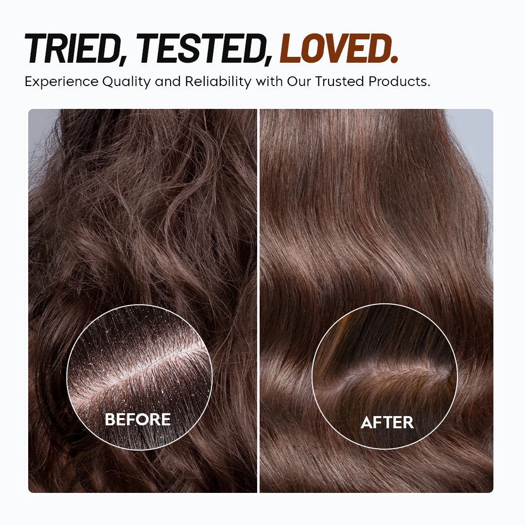 Self Cleaning Dandruff Comb