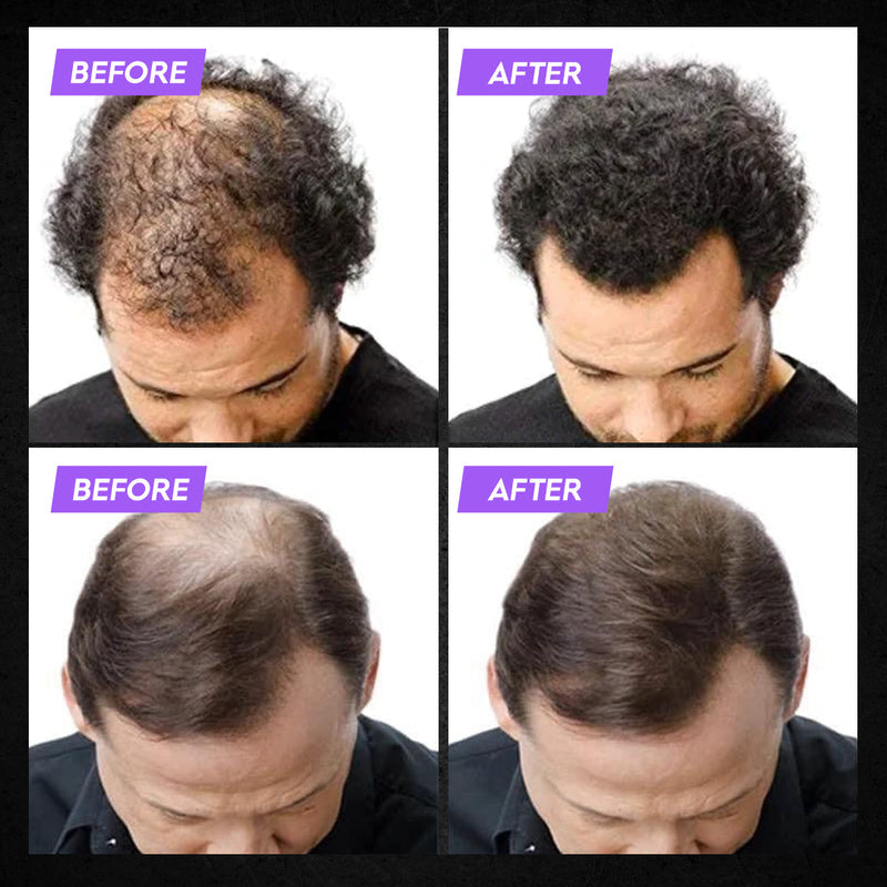 Gleva Hair Building Fiber + (Get Free Applicator)