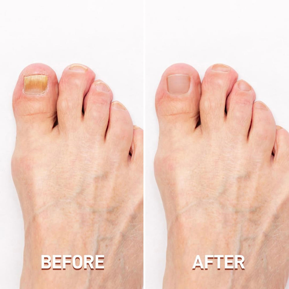 ProCut German Toenail Clipper