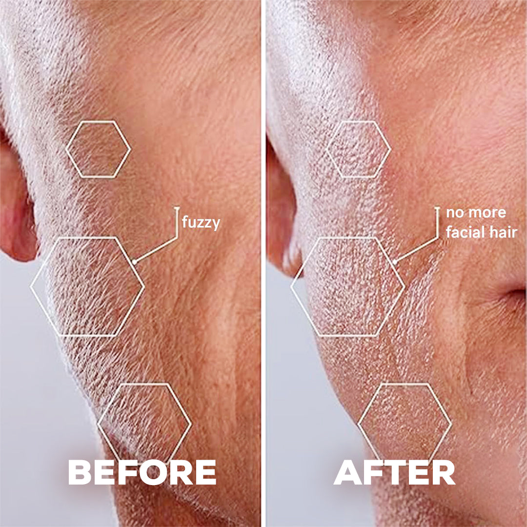 Facial Hair Remover